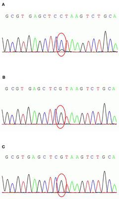 PCDH19-Related Epilepsy in Early Onset of Chinese Male Patient: Case Report and Literature Review